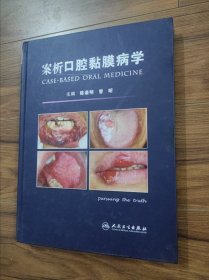 案析口腔黏膜病学