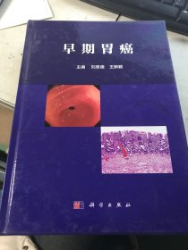 早期胃癌