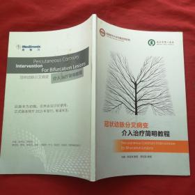 冠状动脉分叉病变介入治疗简明教程