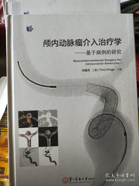 颅内动脉瘤介入治疗学：基于病例的研究