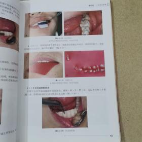 口腔临床操作技术丛书：牙科临床规范化操作图谱（第2版）