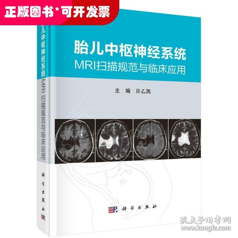 点击查看原图 胎儿中枢神经系统MRI扫描规范与临床应用