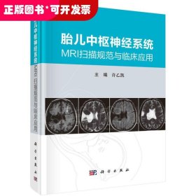 胎儿中枢神经系统MRI扫描规范与临床应用