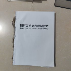 图解颈动脉内膜切除术（宣武医院脑缺血治疗系列丛书）