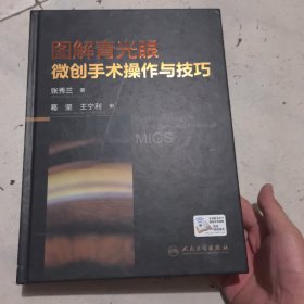 图解青光眼微创手术操作与技巧