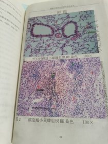 成都中医药大学2000级研究生论文-丹参对实验性肺纤维化形成的影响