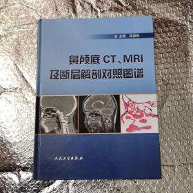 鼻颅底CT、MRI及断层解剖对照图谱