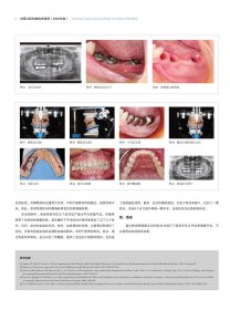 正版书中国口腔种植临床精萃2020年卷