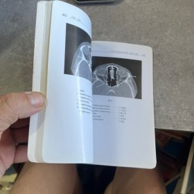 头和脑正常CT解剖袖珍图谱