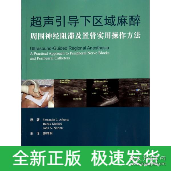 超声引导下区域麻醉：周围神经阻滞及置管实用操作方法