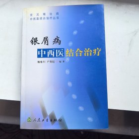 银屑病：中西医结合治疗