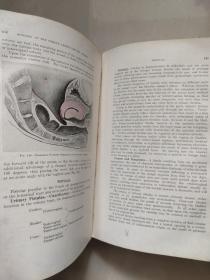 (KEEN'S) SURGERY V :Its principles and practice  (1909年)  英文原版插绘本 <外科手术原理与临床实践>布面精装 16开 厚重