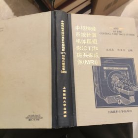 中枢神经系统计算机体层摄影CT核磁共振成像MRI