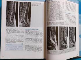 MR Neuroimaging
   Brain,Spine,Peripheral Nerves
  （脑、脊柱、外周神经的MR神经成像）