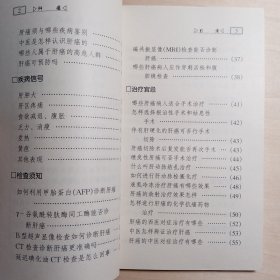 肝癌（健康教育丛书）