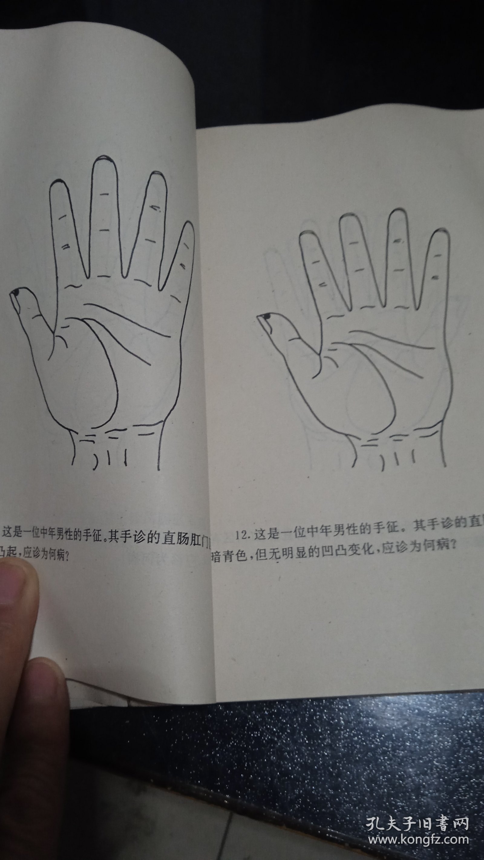 观手治把——气色形态手诊法精要本
