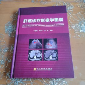 肝癌诊疗影像学图谱