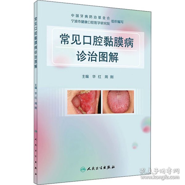 正版 常见口腔黏膜病诊治图解 华红；周刚 9787117317337