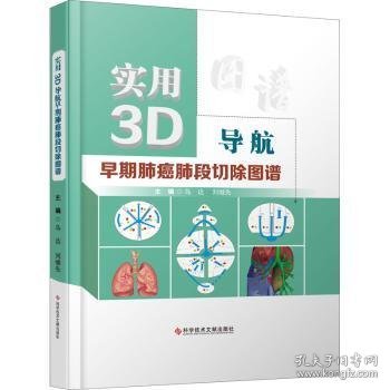 实用3D导航早期肺癌肺段切除图谱