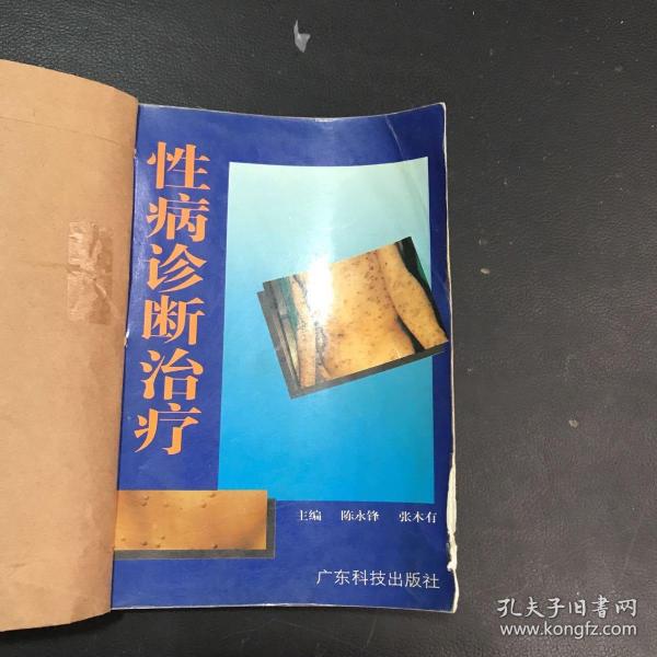 性病诊断治疗