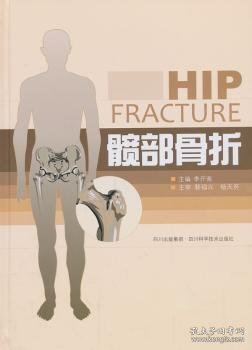 髋部骨折