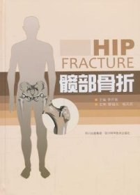 髋部骨折