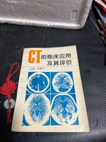 CT的临床应用及其评价