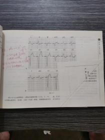 心电图临床实习图谱（第3版）