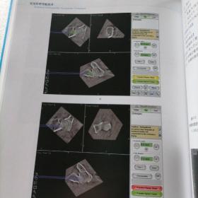 保证正版特价绝版好书！《实用骨科导航技术》品相好， 第2版 精装大16开，293页，印刷精美； 全铜版纸印。主编周东生。品相好，新书库存，塑封全新包装外皮九九品几乎全新，里面干净无翻阅。定价200元。人民军医出版社，值得阅读学习收藏！包好二斤多重！市场价格100元一本以上。