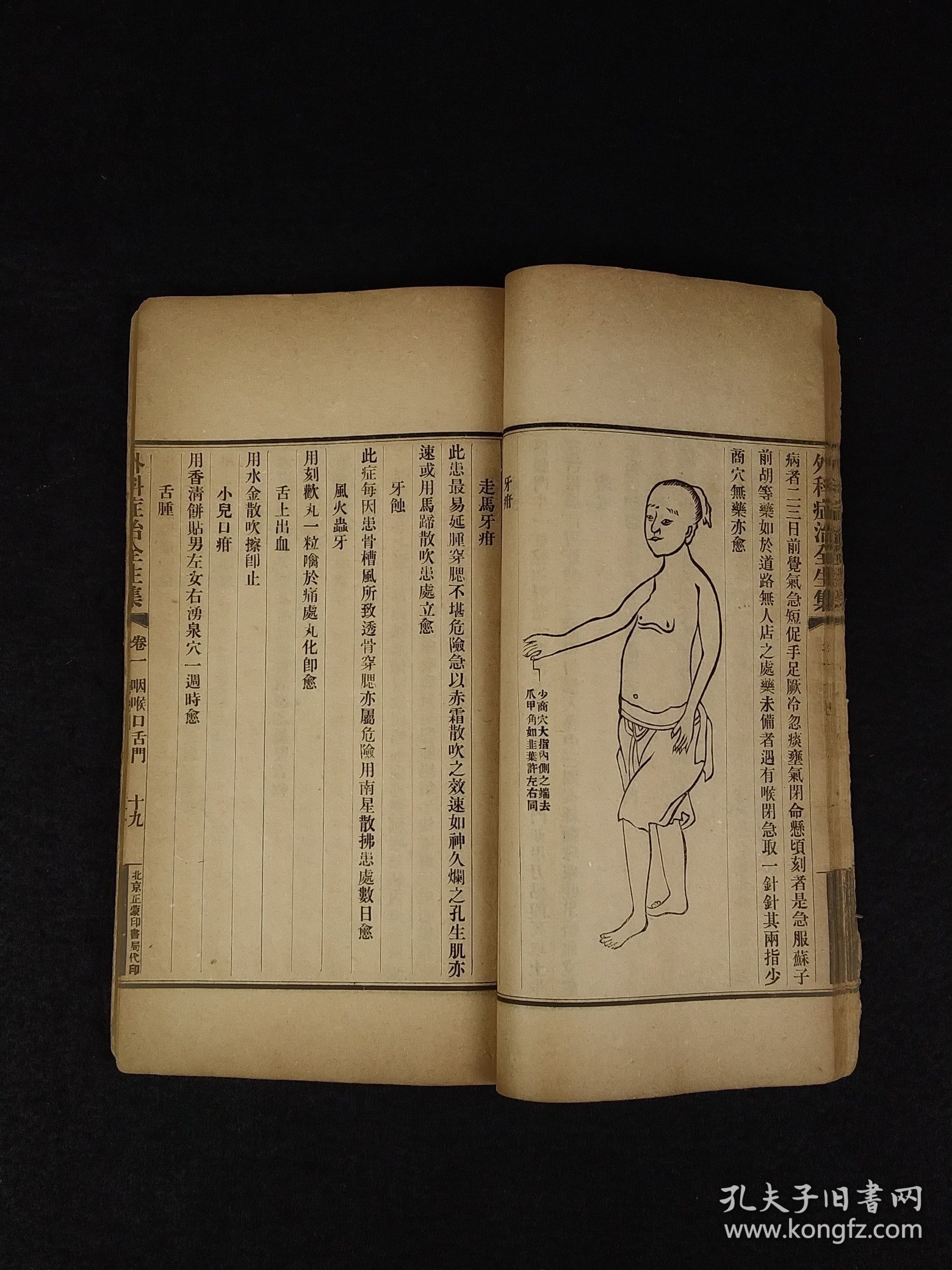 清末民国时期【王洪绪外科症治全生+荘在田先生儿科全集】全套完整无缺。王维德 字洪绪、别号林屋散人、自幼习医，因家学渊源，擅长外科，兼通内、妇、儿科，行医四十余年，系总结家传与作者本人临床经验写成！