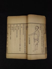 清末民国时期【王洪绪外科症治全生+荘在田先生儿科全集】全套完整无缺。王维德 字洪绪、别号林屋散人、自幼习医，因家学渊源，擅长外科，兼通内、妇、儿科，行医四十余年，系总结家传与作者本人临床经验写成！