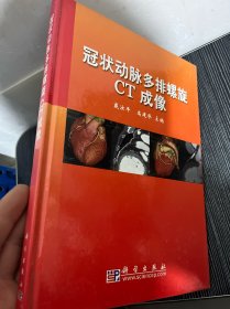 冠状动脉多排螺旋CT成像