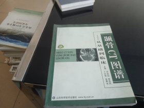 颞骨CT图谱：从基础到临床