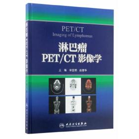 淋巴瘤PET/CT影像学