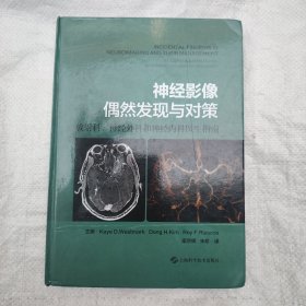 神经影像偶然发现与对策--放射科、神经外科和神经内科医生指南