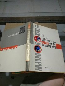 心脏超声鉴别诊断图谱
