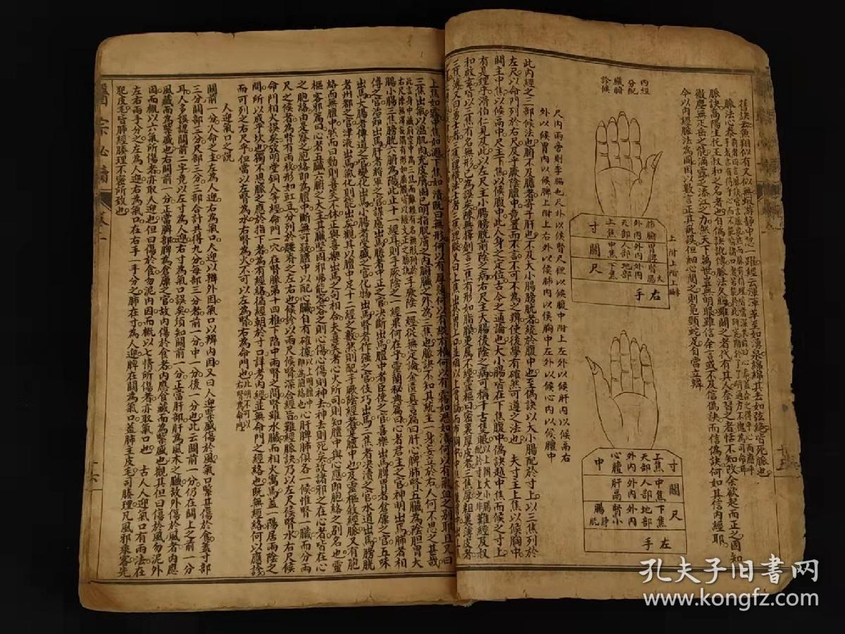清末民国时期【医宗必读】综合性医书。四本合订共十卷。卷一医论及图说。卷二为新著四言脉诀、脉法心参及色诊三篇。卷三-四本草征要。卷五-十论述以内科杂病为主的证因及治疗，并附医案。保存完整无缺页，单页尺寸20/13.2厘米，品相如图！