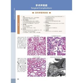 移植诊断病理学 原书第2版(美)安东尼·张,(美)罗伯特·B.科尔文9787504690555中国科学技术出版社