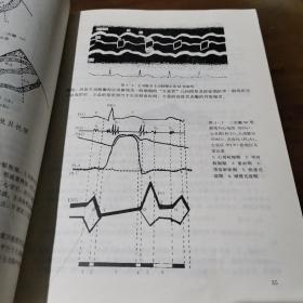 临床实用超声心动图学