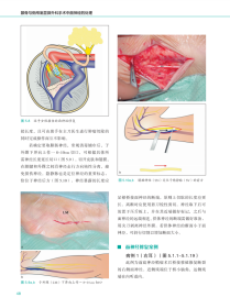 全新正版颞骨与侧颅底显微外科手术中面神经的处理9787519273781