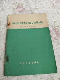 针负临床取穴图