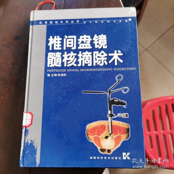 椎间盘镜髓核摘除术