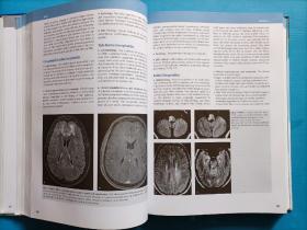 MR Neuroimaging
   Brain,Spine,Peripheral Nerves
  （脑、脊柱、外周神经的MR神经成像）
