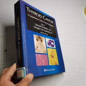 thyroid cancer second edition