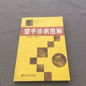 望手诊病图解