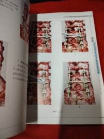 脊柱内固定系统应用指南
