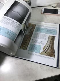1984年COLOR ATLAS OF HUMAN ANATOMY 人体解剖彩色图集，伦敦大学解剖学教授联合主编，大16开357页精装