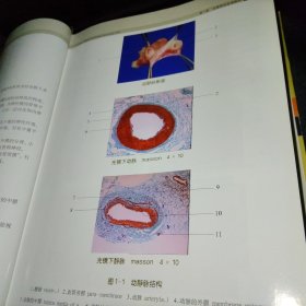 钟世镇临床解剖学图谱全集：钟世镇显微外科临床解剖学图谱 签名本：非常难得2009年第1版第1次印刷