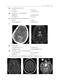 神经影像学：核心复习