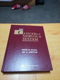 black loeffler cancer of the nervous system 神經系統(tǒng)黑洛弗勒癌癥